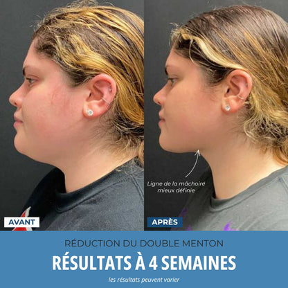 LumoSkyn Pro 2™ - Sculpteur Visage et Cou