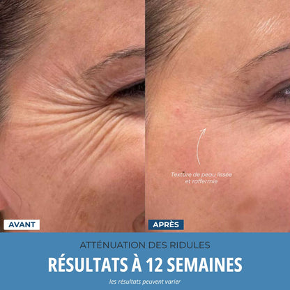 LumoSkyn Pro 2 - Sculpteur Visage et Cou