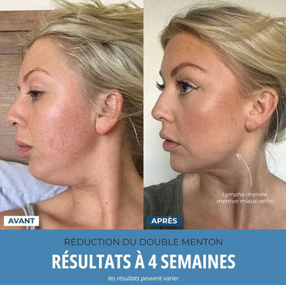 LumoSkyn Pro 2 - Sculpteur Visage et Cou