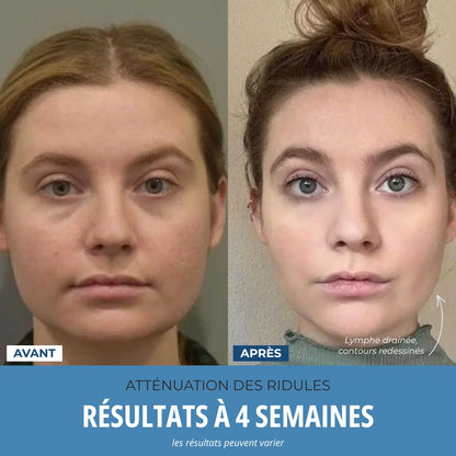 LumoSkyn Pro 2™ - Sculpteur Visage et Cou