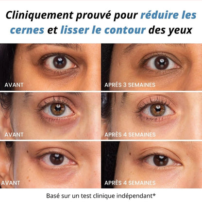 Lumo Eyes Pro - Stylet LED Anti-Cernes